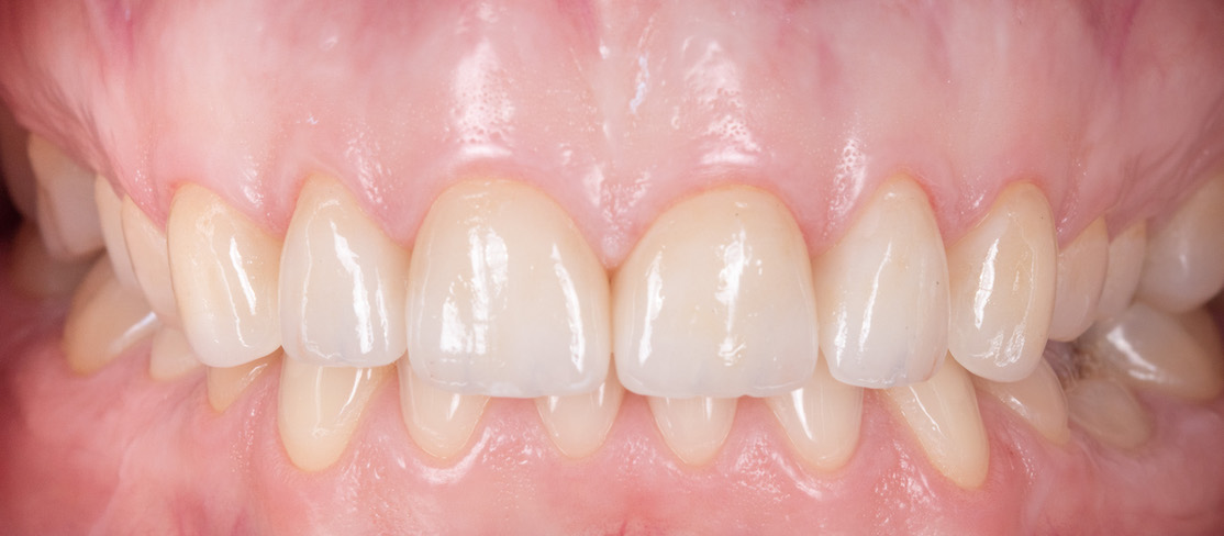 Moje práce po zákroku