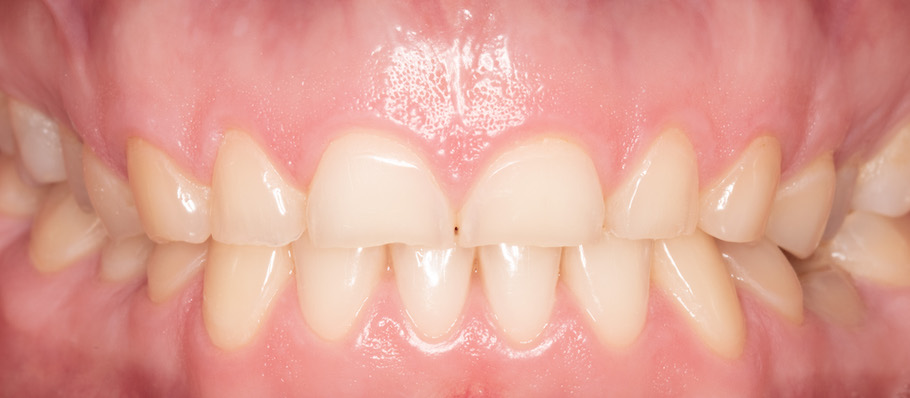 Moje práce před zákrokem