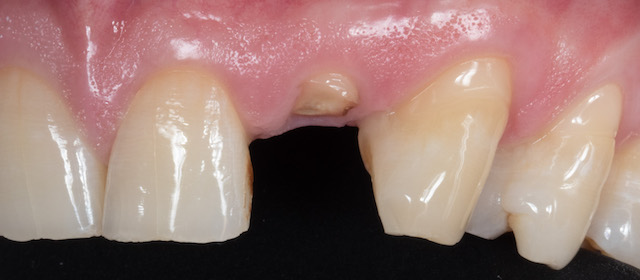 Moje práce před zákrokem