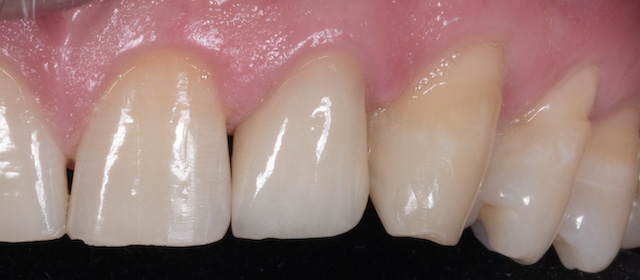 Moje práce po zákroku