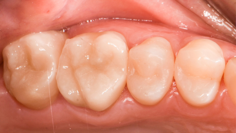 Moje práce po zákroku