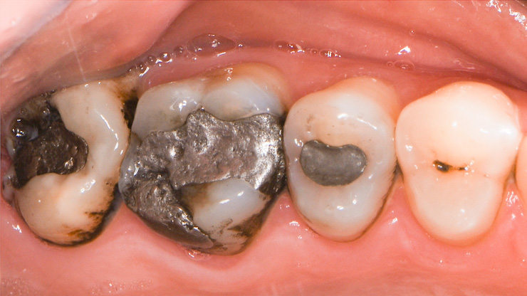 Moje práce před zákrokem