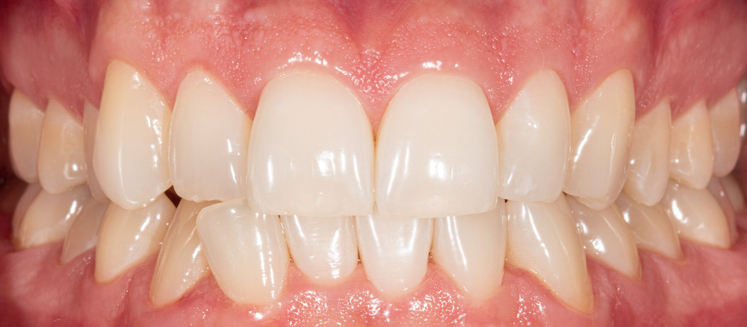 Moje práce po zákroku