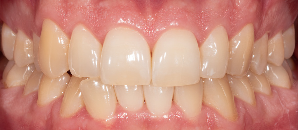 Moje práce před zákrokem