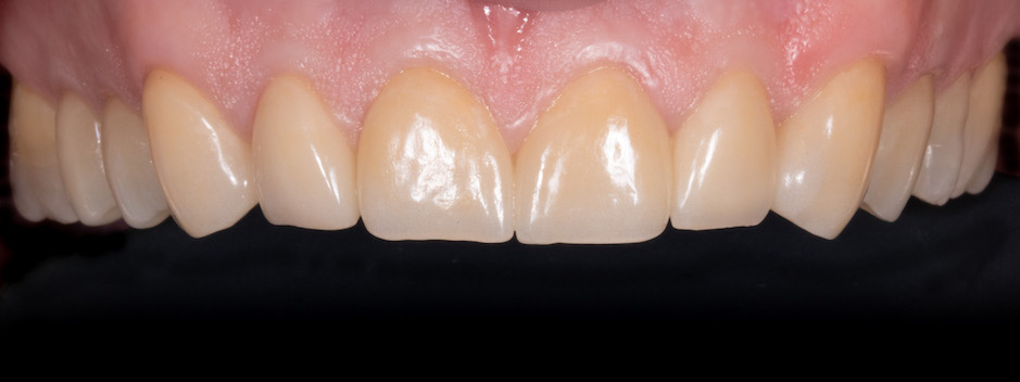 Moje práce po zákroku