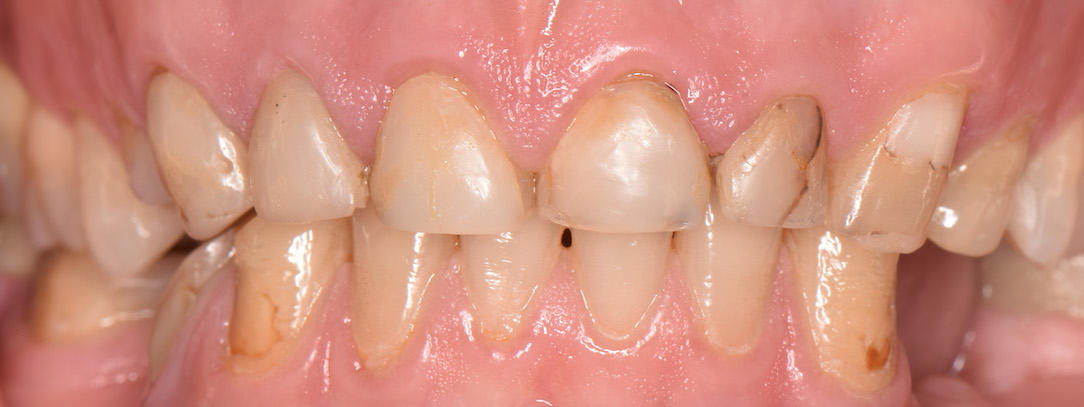 Moje práce před zákrokem