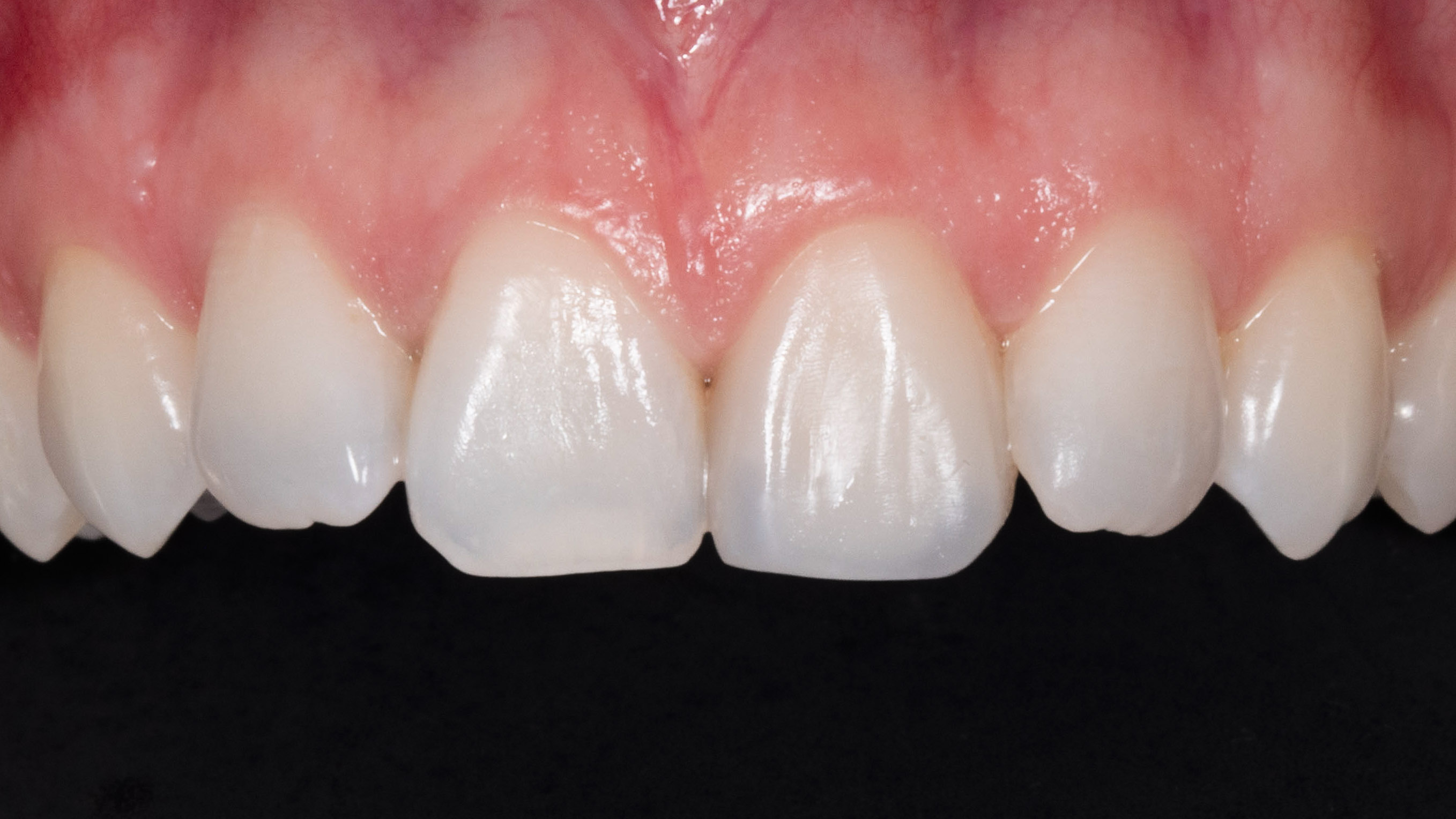 Moje práce po zákroku