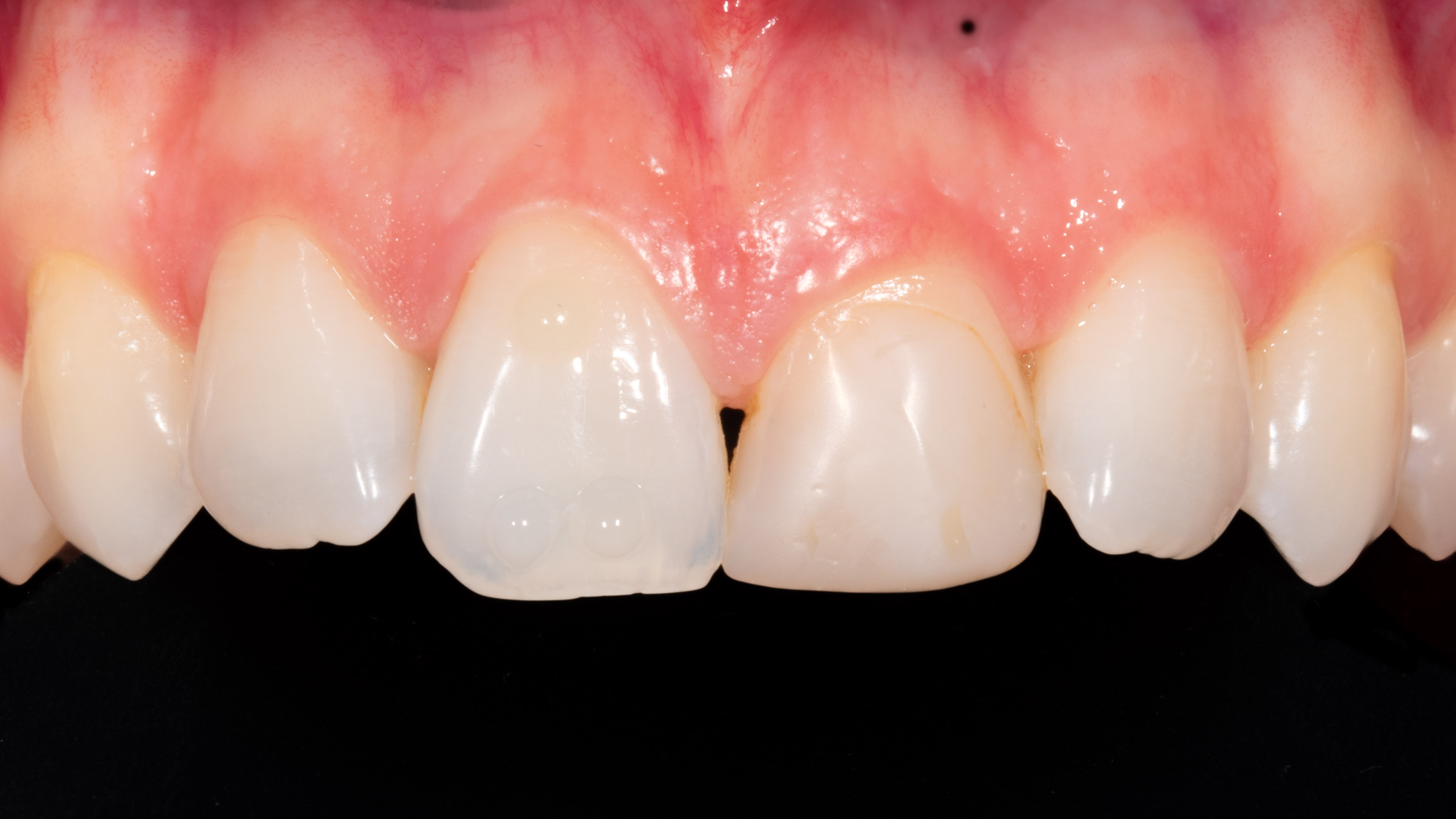 Moje práce před zákrokem